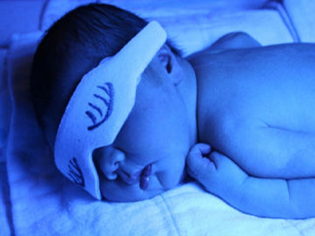 neonato fototerapia